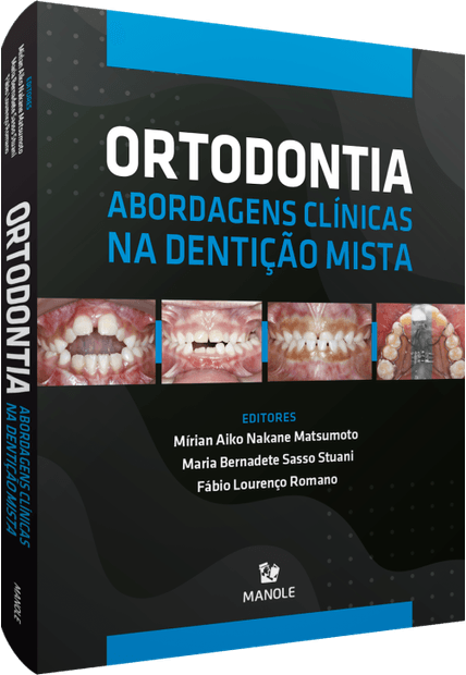 Ortodontia: Abordagens Clínicas na Dentição Mista