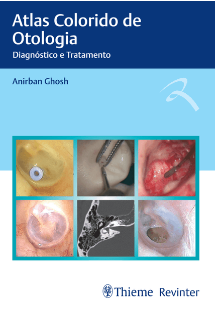 Atlas Colorido de Otologia: Diagnóstico e Tratamento