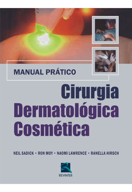 Cirurgia Dermatologica Cosmética: Manual Prático