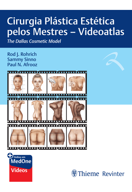Cirurgia Plástica Estética pelos Mestres: The Dallas Cosmetic Model, Videoatlas