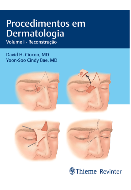 Procedimentos em Dermatologia: Volume I - Reconstrução