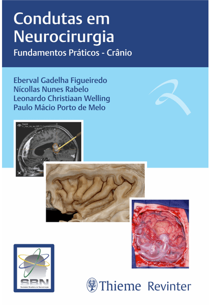 Sbn Condutas em Neurocirurgia: Fundamentos Práticos - Crânio